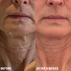 Peptide Face & Neck Night Cream 50ml